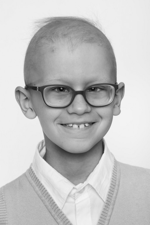 Zdjęcie chłopczyka w okularach z rzadkimi włosami